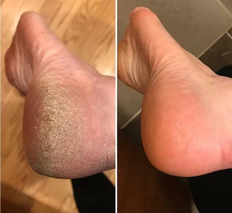 Antes y Después