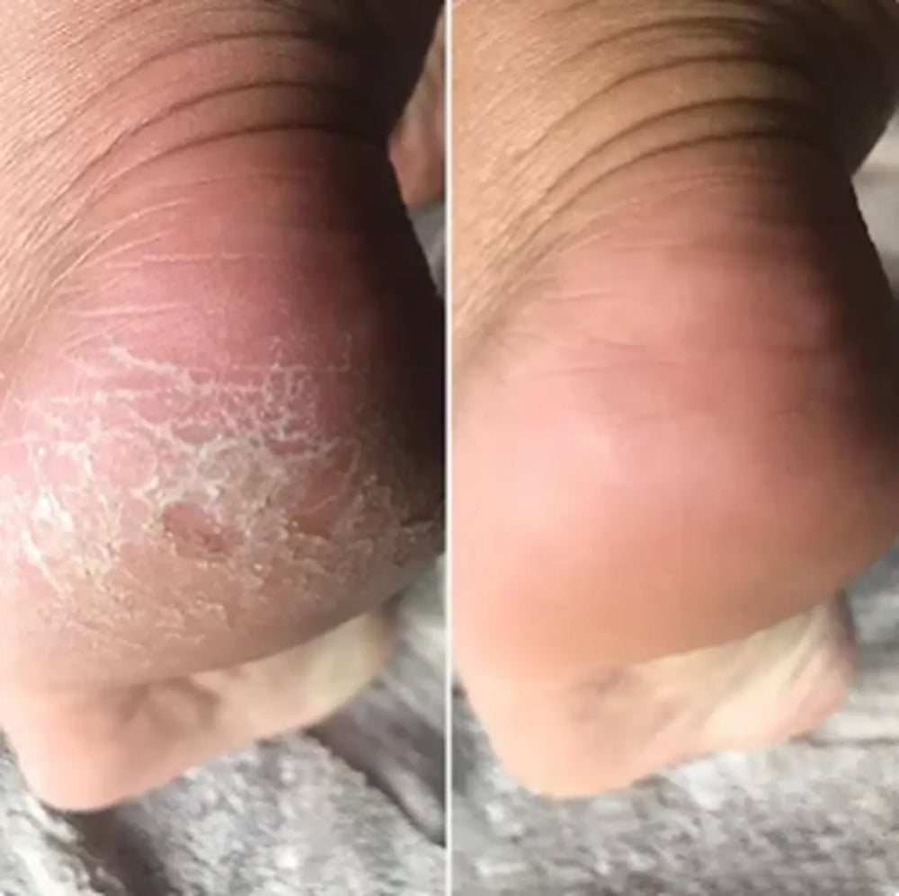 Antes y Después