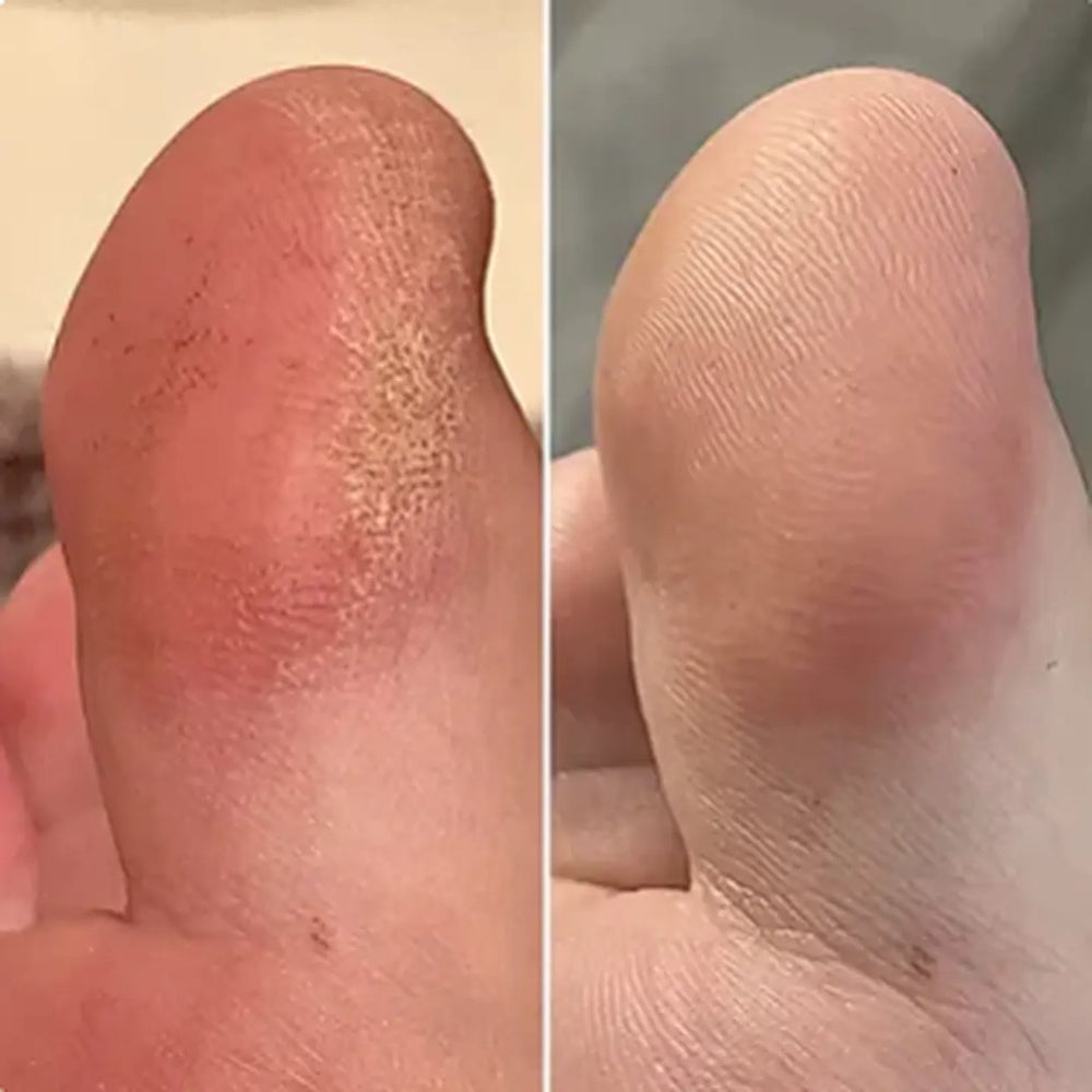 Antes y Después